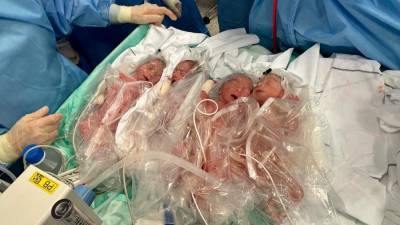 Četverčki v ljubljanski porodnišnici (UKC/FACEBOOK)