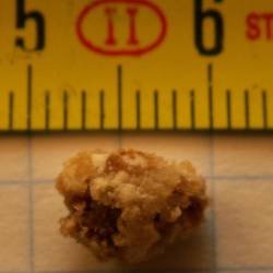 Ledvični kamen je usedlina mineralov in soli, ki nastane v ledvicah zaradi koncentriranega urina, pomanjkanja tekočine ali prehrane