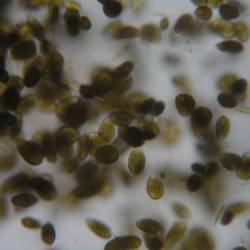 Mikroalga Ostreopsis ovata (ARPA FJK)