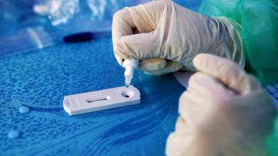 Serološki test (simbolična fotografija ANSA)