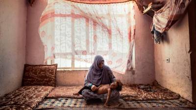 Fotografija Marca Gualazzinija priča o lakoti in splošni ekonomski krizi v Afganistanu. Ovekovečil je 35-letno Shazio Saydi, mamo 7 otrok, med katerimi je 6-letna Setayesh, ki 4 leta trpi zaradi podhranjenosti (MARCO GUALAZZINI)