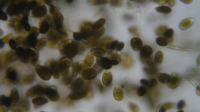 Mikroalga Ostreopsis ovata (ARPA FJK)