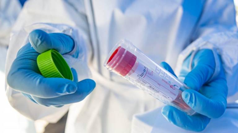 V Sloveniji delež pozitivnih PCR testov 16,2-odstoten