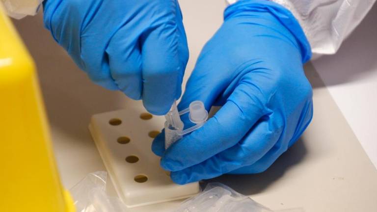 Z dolgim covidom se sooča vse manj ljudi