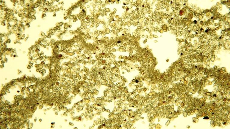 Mikrofotografija včeraj&scaron;njega peska v dežju