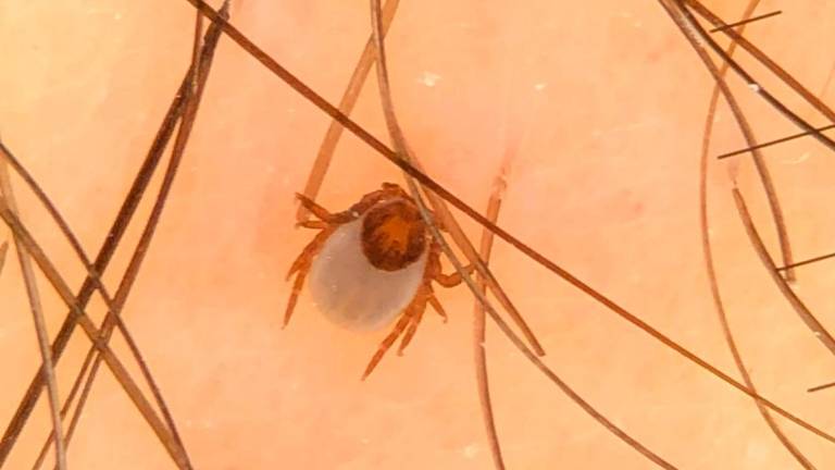 Klopi, spet ta nadloga