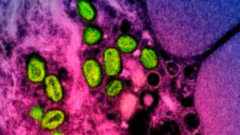 Nova različica opičje kuge tudi v Evropi