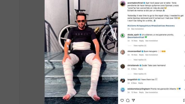 Contadorju odstranili več kot 100 lipomov