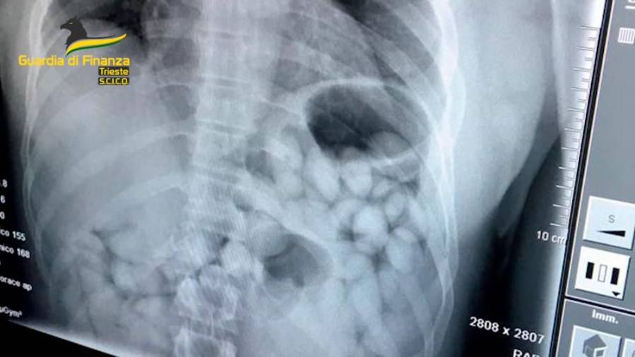 Kapsule na rentgenskem posnetku (FINANČNA POLICIJA)