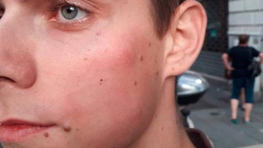 $!Žrtev pretepa (SINISTRA CLASSE RIVOLUZIONE)